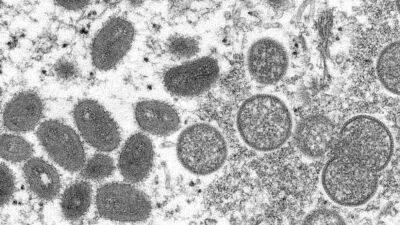 Monkeypox: WHO declares global health emergency over 'extraordinary' outbreak